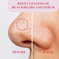 Rice Oil Makeup Remover | Totemica